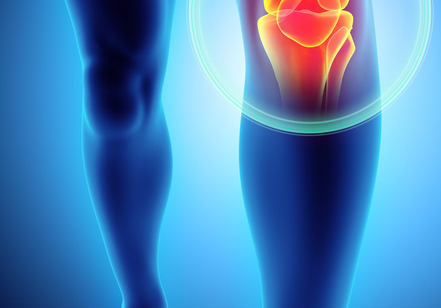 Knee painful - skeleton x-ray, 3D Illustration medical concept.